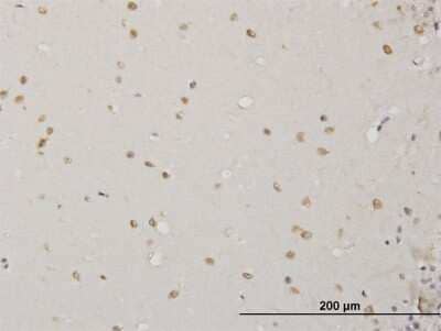 Immunohistochemistry-Paraffin: ABL2 Antibody (5C6) [H00000027-M09] - Analysis of monoclonal antibody to ABL2 on formalin-fixed paraffin-embedded human cerebellum. Antibody concentration 1.5 ug/ml