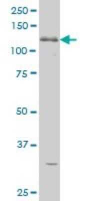 Western Blot: ABL2 Antibody (5C6) [H00000027-M09] - Analysis of ABL2 expression in K-562 (Cat # L009V1).