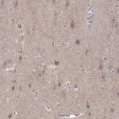 Immunohistochemistry-Paraffin: ABL2 Antibody [NBP2-68946] - Staining of human cerebral cortex shows weak cytoplasmic positivity in neurons and neuropil.