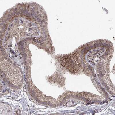 Immunohistochemistry-Paraffin: ABL2 Antibody [NBP2-68946] - Staining of human gallbladder shows moderate cytoplasmic positivity in glandular cells.