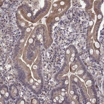 Immunohistochemistry-Paraffin: ABL2 Antibody [NBP2-68946] - Staining of human gastrointestinal shows moderate cytoplasmic positivity in glandular cells.
