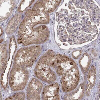 Immunohistochemistry-Paraffin: ABL2 Antibody [NBP2-68946] - Staining of human kidney shows moderate cytoplasmic positivity in cells in tubules.