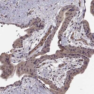Immunohistochemistry-Paraffin: ABL2 Antibody [NBP2-68946] - Staining of human placenta shows weak cytoplasmic positivity in trophoblastic cells.