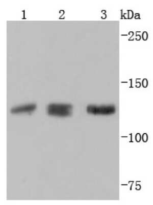 Western Blot: ABL2 Antibody (JF0951) [NBP2-67106] - Analysis of ABL2 on different lysates using anti-ABL2 antibody at 1/1,000 dilution. Positive control: Lane 1: Hela Lane 2: PC-12 Lane 3: Jurkat