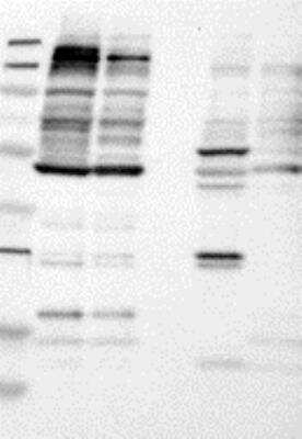 Western Blot: ABL2 Antibody [23270002] - Lane 1, Marker [kDa]: 250, 130, 95, 72, 55, 36, 28, 17, 11 Ln 2, RT-4 Ln 3, U-251MG sp Ln 4, Human Plasma Ln 5, Liver Ln 6, Tonsil, Target weight [kDa]: 128, 116, 110 (splice variants) Validation score: 2.