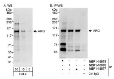 Western Blot ABL2 Antibody - BSA Free