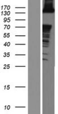 Western Blot ABL2 Overexpression Lysate