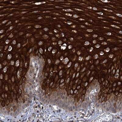 Immunohistochemistry-Paraffin ABLIM1 Antibody - BSA Free