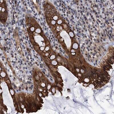 Immunohistochemistry-Paraffin: ABLIM1 Antibody [NBP1-89304] - Staining of human rectum shows strong cytoplasmic and membranous positivity in glandular cells.