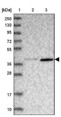 Western Blot ABLIM1 Antibody - BSA Free