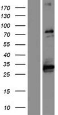 Western Blot ABLIM1 Overexpression Lysate