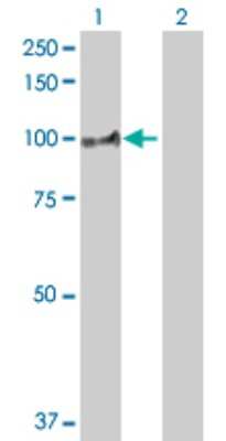 Western Blot: ABP1/AOC1 Antibody [H00000026-D01P] - Analysis of ABP1 expression in transfected 293T cell line by ABP1 polyclonal antibody.Lane 1: ABP1 transfected lysate(85.30 KDa).Lane 2: Non-transfected lysate.