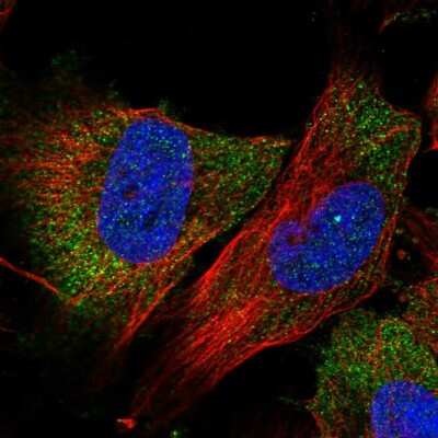 Immunocytochemistry/Immunofluorescence: ABRO Antibody [NBP2-56296] - Staining of human cell line U-251 MG shows localization to cytosol.