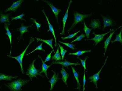 Immunocytochemistry/Immunofluorescence: ABRO Antibody [NBP2-97533] - Immunofluorescence staining of ABRO in HeLa cells. Cells were fixed with 4% PFA, permeabilzed with 0.1% Triton X-100 in PBS, blocked with 10% serum, and incubated with rabbit anti-Human ABRO polyclonal antibody (dilution ratio 1:1000) at 4C overnight. Then cells were stained with the Alexa Fluor(R)488-conjugated Goat Anti-rabbit IgG secondary antibody (green) and counterstained with DAPI (blue).Positive staining was localized to Cytoplasm.