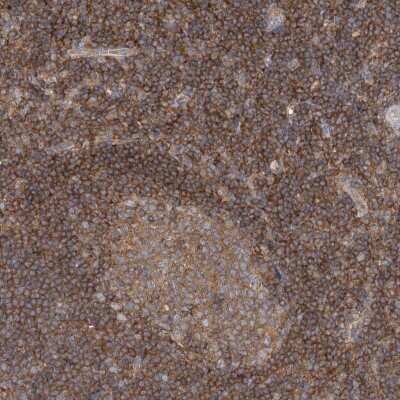 Immunohistochemistry-Paraffin: ABRO Antibody [NBP1-90282] - Staining of human tonsil shows strong cytoplasmic positivity in germinal center cells and non-germinal center cells.