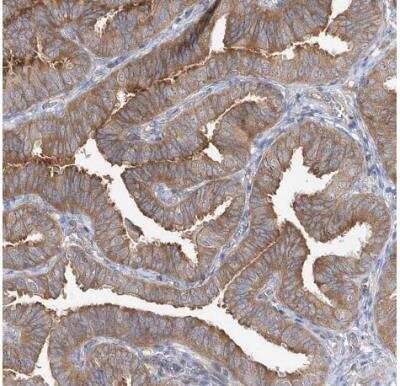 Immunohistochemistry-Paraffin: ABRO Antibody [NBP1-90282] - Staining of human fallopian tube shows moderate cytoplasmic positivity in glandular cells.