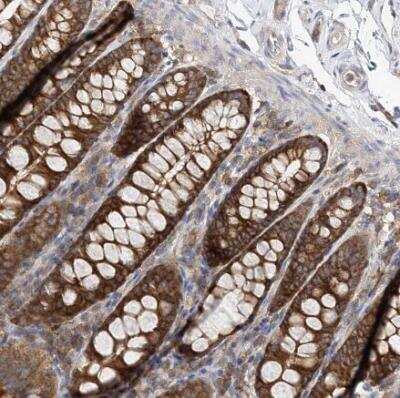 Immunohistochemistry-Paraffin: ABRO Antibody [NBP1-90282] - Staining of human colon strong cytoplasmic positivity in glandular cells.