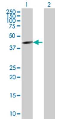 Western Blot: ABRO Antibody [H00023172-B01P] - Analysis of FAM175B expression in transfected 293T cell line by FAM175B polyclonal antibody.  Lane 1: KIAA0157 transfected lysate(34.21 KDa). Lane 2: Non-transfected lysate.