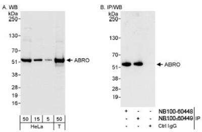 Western Blot: ABRO Antibody [NB100-60448] - Detection of Human ABRO on HeLa whole cell lysates using NB100-60448. ABRO was also immunoprecipitated by rabbit anti-ABRO antibody NB100-60449.