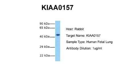 Western Blot: ABRO Antibody [NBP1-56788] - Sample Tissue: Human Fetal Lung Antibody Dilution: 1.0 ug/ml