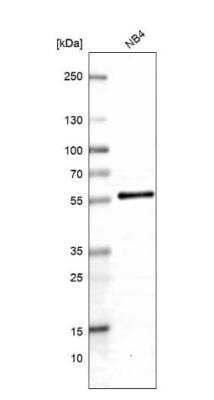 Western Blot: ABRO Antibody [NBP1-90282] - Analysis in human cell line NB4.