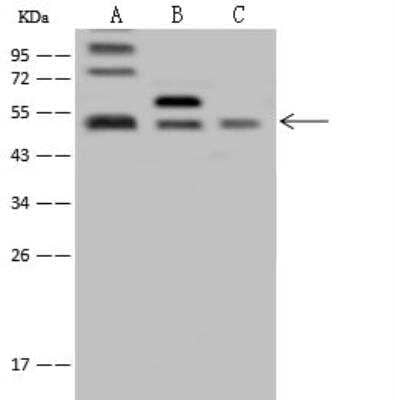 Western Blot: ABRO Antibody [NBP2-97533] - Lane A: U-251 MG Whole Cell LysateLane B: NIH-3T3 Whole Cell LysateLane C: HepG2 Whole Cell LysateLysates/proteins at 30 ug per lane.SecondaryGoat Anti-Rabbit IgG (H+L)/HRP at 1/10000 dilution.Developed using the ECL technique.Performed under reducing conditions.Predicted band size:47 kDaObserved band size:50 kDa