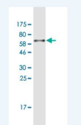 Western Blot: ABT1 Antibody (1B3) [H00029777-M04A-200ul] - Detection against Immunogen (55.66 KDa) .
