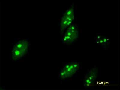 Immunocytochemistry/ Immunofluorescence ABT1 Antibody