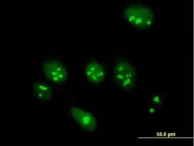 Immunocytochemistry/Immunofluorescence: ABT1 Antibody [H00029777-B02P] - Analysis of purified antibody to ABT1 on HeLa cell. (antibody concentration 10 ug/ml)
