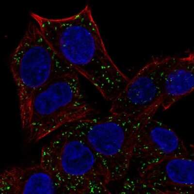 Immunocytochemistry/Immunofluorescence: ABT1 Antibody [NBP2-69030] - Staining of human cell line Hep G2 shows localization to vesicles.