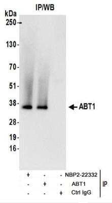 <b>Biological Strategies Validation. </b>Immunoprecipitation: ABT1 Antibody [NBP2-22332] - Whole cell lysate (1 mg for IP; 20% of IP loaded) from 293T cells.  Antibodies:  NBP2-22332 used for IP at 6 ug/mg lysate.  ABT1 was also immunoprecipitated by rabbit anti-ABT1 antibody.  For blotting immunoprecipitated ABT1, NBP2-22332 was used at 1 ug/ml.  Detection: Chemiluminescence with an exposure time of 3 seconds.