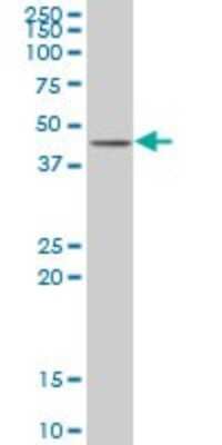 Western Blot ABT1 Antibody