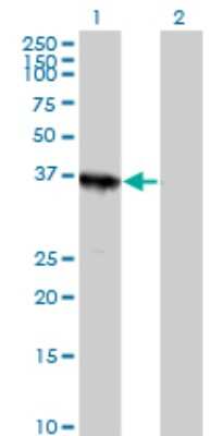 Western Blot ABT1 Antibody