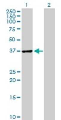 Western Blot ABT1 Antibody - Azide and BSA Free