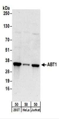 Western Blot: ABT1 Antibody [NBP2-22332] - Whole cell lysate (50 ug) from 293T, HeLa, and Jurkat cells.  NBP2-22332 used for WB at 0.1 ug/ml.  Detection: Chemiluminescence with an exposure time of 30 seconds.