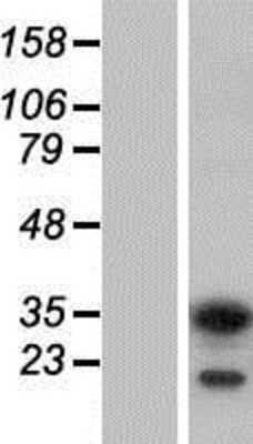 Western Blot ABT1 Overexpression Lysate