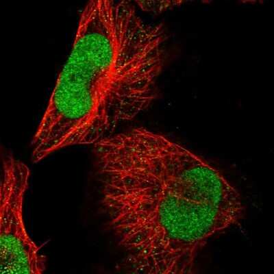 Immunocytochemistry/ Immunofluorescence ABTB2 Antibody - BSA Free