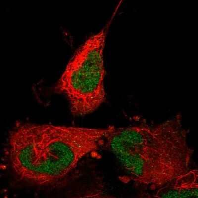 Immunocytochemistry/ Immunofluorescence ABTB2 Antibody - BSA Free