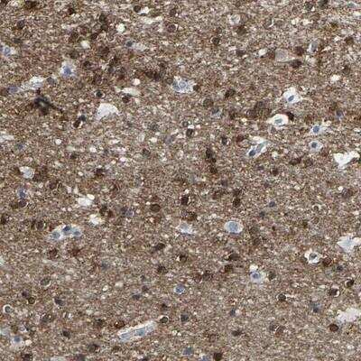 Immunohistochemistry-Paraffin: ABTB2 Antibody [NBP1-84141] - Staining of human cerebral cortex shows strong cytoplasmic positivity in glial cells.