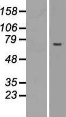 Western Blot: ABTB2 Overexpression Lysate (Adult Normal) [NBL1-07215] Left-Empty vector transfected control cell lysate (HEK293 cell lysate); Right -Over-expression Lysate for ABTB2.