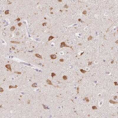 Immunohistochemistry-Paraffin: AC011484.2 Antibody [NBP2-58266] - Staining of human cerebral cortex shows high expression.