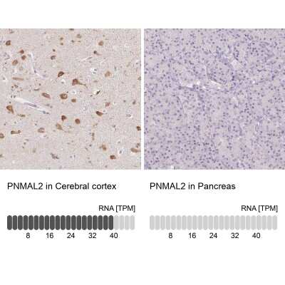 Immunohistochemistry-Paraffin: AC011484.2 Antibody [NBP2-58266] - Staining in human cerebral cortex and pancreas tissues using anti-PNMAL2 antibody. Corresponding PNMAL2 RNA-seq data are presented for the same tissues.