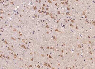 Immunohistochemistry-Paraffin: AC011484.2 Antibody [NBP3-06547] - Staining of human PNMAL2 in human brain with rabbit polyclonal antibody at 1:500 dilution.