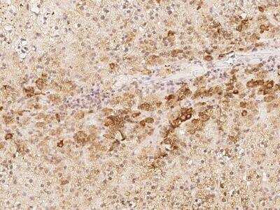 Immunohistochemistry-Paraffin: AC011484.2 Antibody [NBP3-06547] - Staining of human PNMAL2 in human adrenal gland with rabbit polyclonal antibody at 1:500 dilution.s
