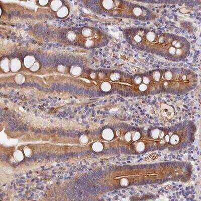 Immunohistochemistry MISP3 Antibody - BSA Free