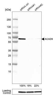 Western Blot: ACAD9 Antibody [NBP1-82749] - Analysis in MCF-7 cells transfected with control siRNA, target specific siRNA probe #1 and #2. Remaining relative intensity is presented. Loading control: Anti-GAPDH.