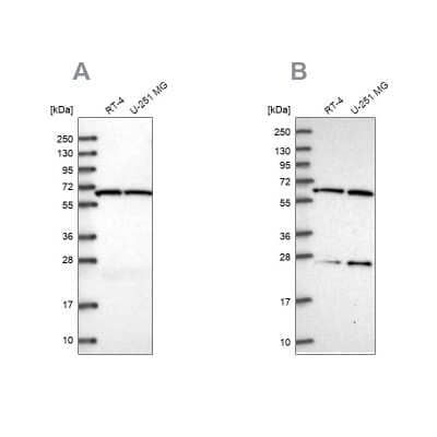 Western Blot: ACAD9 Antibody [NBP1-82749] - Analysis using Anti-ACAD9 antibody NBP1-82749 (A) shows similar pattern to independent antibody NBP2-56718 (B).