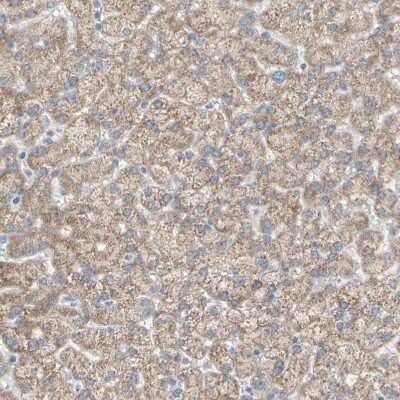 Immunohistochemistry-Paraffin: ACADL Antibody [NBP1-89289] - Staining of human liver shows moderate cytoplasmic positivity in hepatocytes.