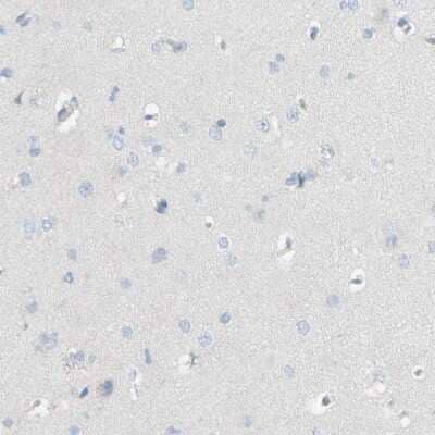 Immunohistochemistry-Paraffin: ACADL Antibody [NBP1-89289] - Staining of human cerebral cortex shows no positivity as expected.