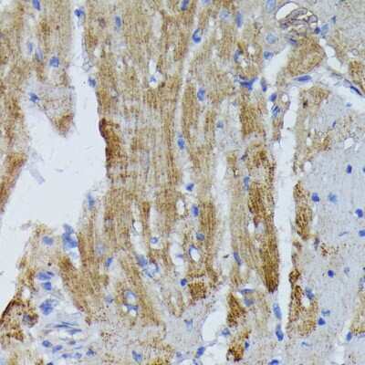 Immunohistochemistry-Paraffin: ACADL Antibody [NBP2-92854] - Mouse heart using ACADL antibody at dilution of 1:100 (40x lens).